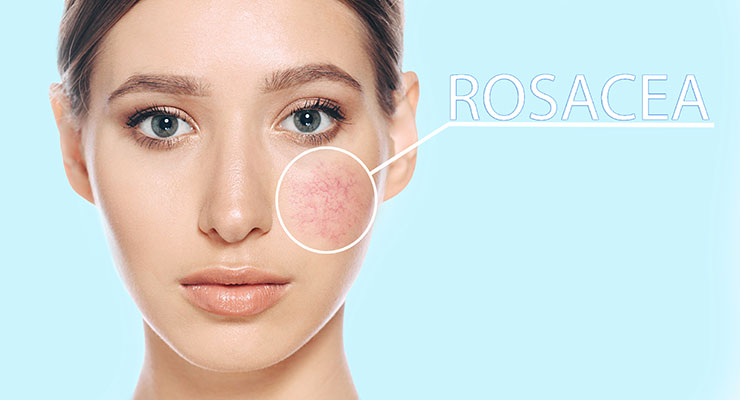 Hepran Sulfate Is the Latest Addition to the Skincare Formulator’s Toolkit