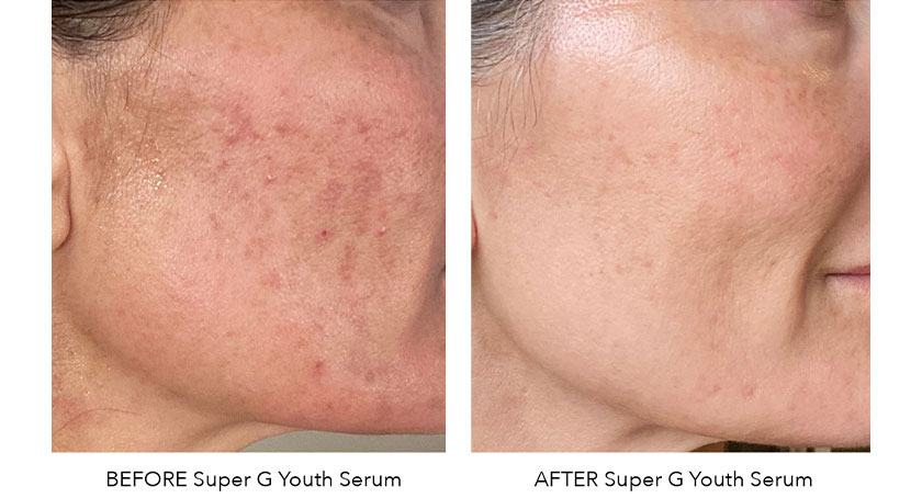 Harnessing the Power of Smart Skincare with Six Gldn